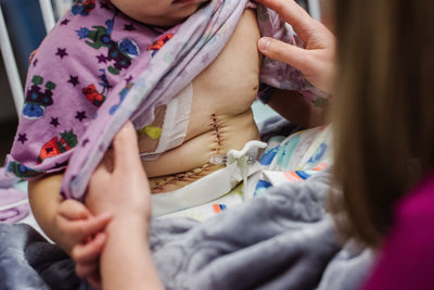 Liver Transplant The Children's Hospital of Philadelphia 