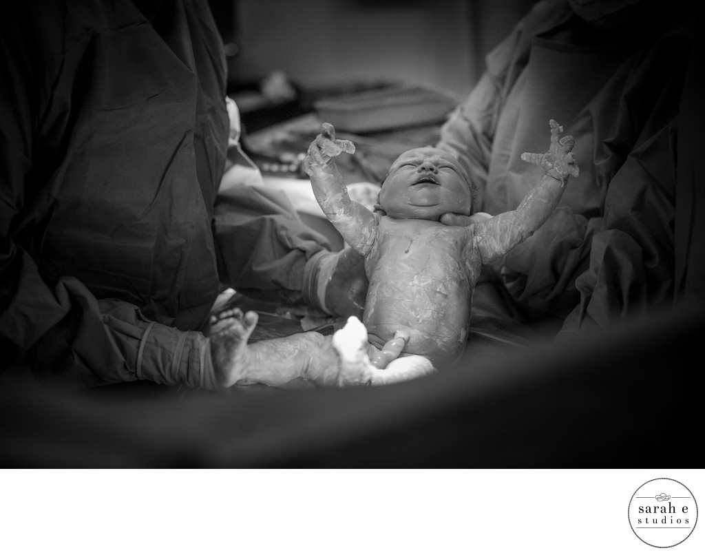 C-Section Birth Story at Mercy Hospital in St. Louis