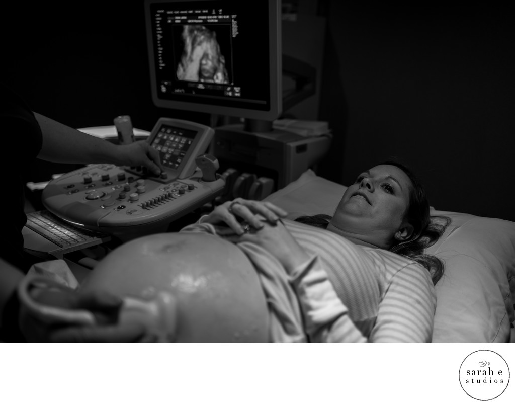 Pregnancy Photography in Ultrasound