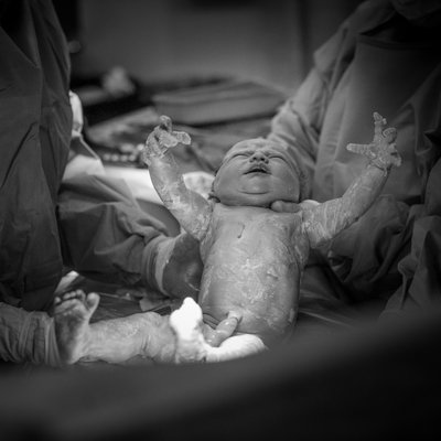 C-Section Birth Story at Mercy Hospital in St. Louis