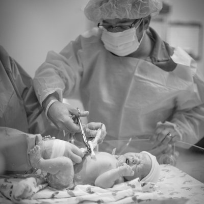 Image of Dad Cutting Cord in a Birth Story